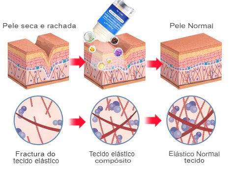 Fivfivgo™ - Creme Intensivo Reparador de Rachaduras