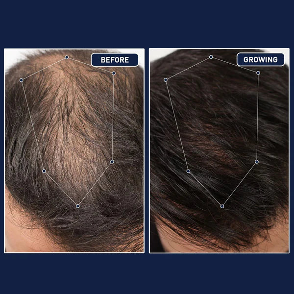 FEG™ NMN - Sérum Folículo Reverso