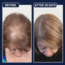 FEG™ NMN - Sérum Folículo Reverso