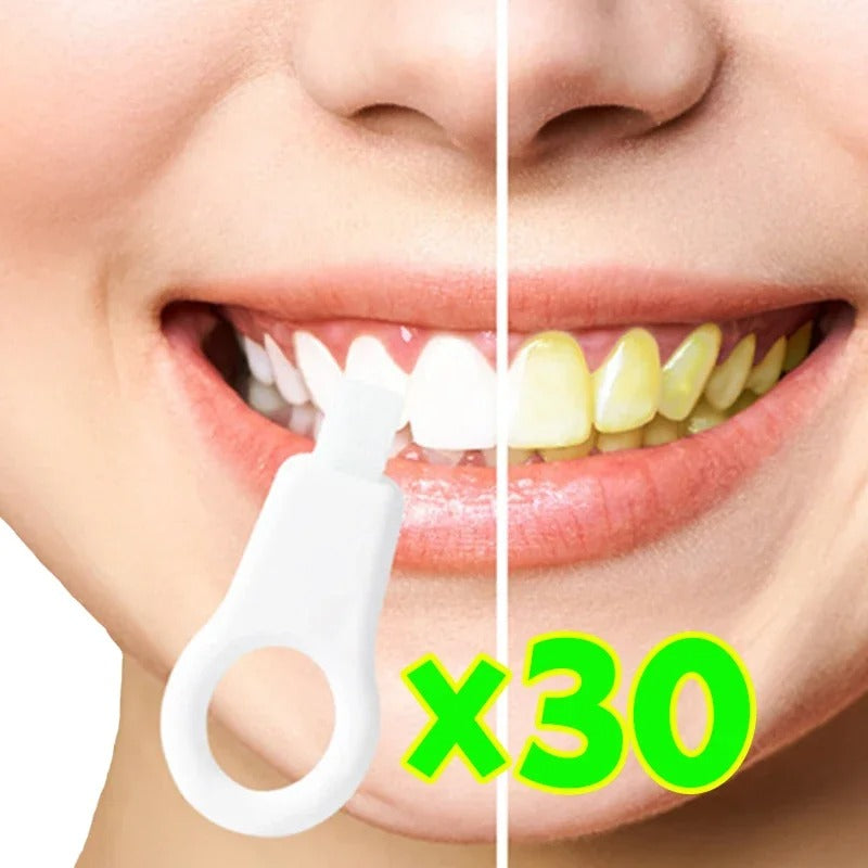 ✨Removedor de manchas dentais Nano Cleaning - kit com 30 peças ❤🤞