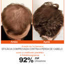 Tratamento Capilar - Re:ACT Minoxi Roll-On