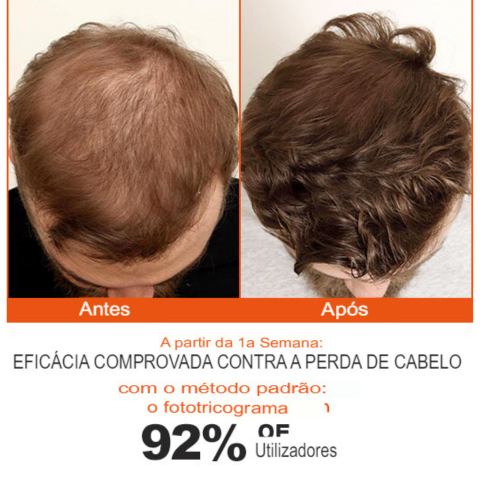 Tratamento Capilar - Re:ACT Minoxi Roll-On