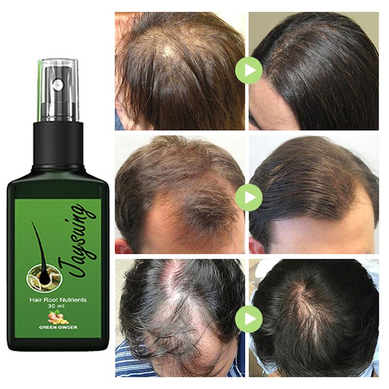 Neo Hair Lotion® - Óleo essencial capilar