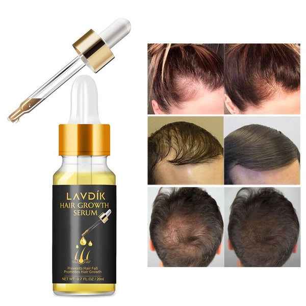 Lavdik- Hair Growth Serum crescimento capilar